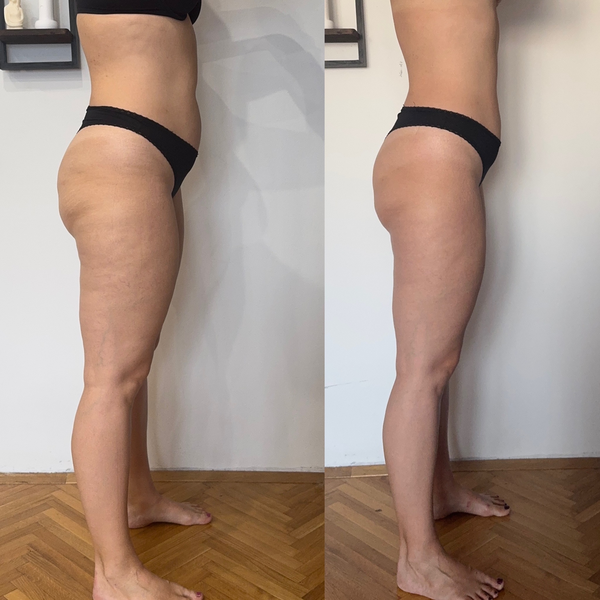 Transformacija 1